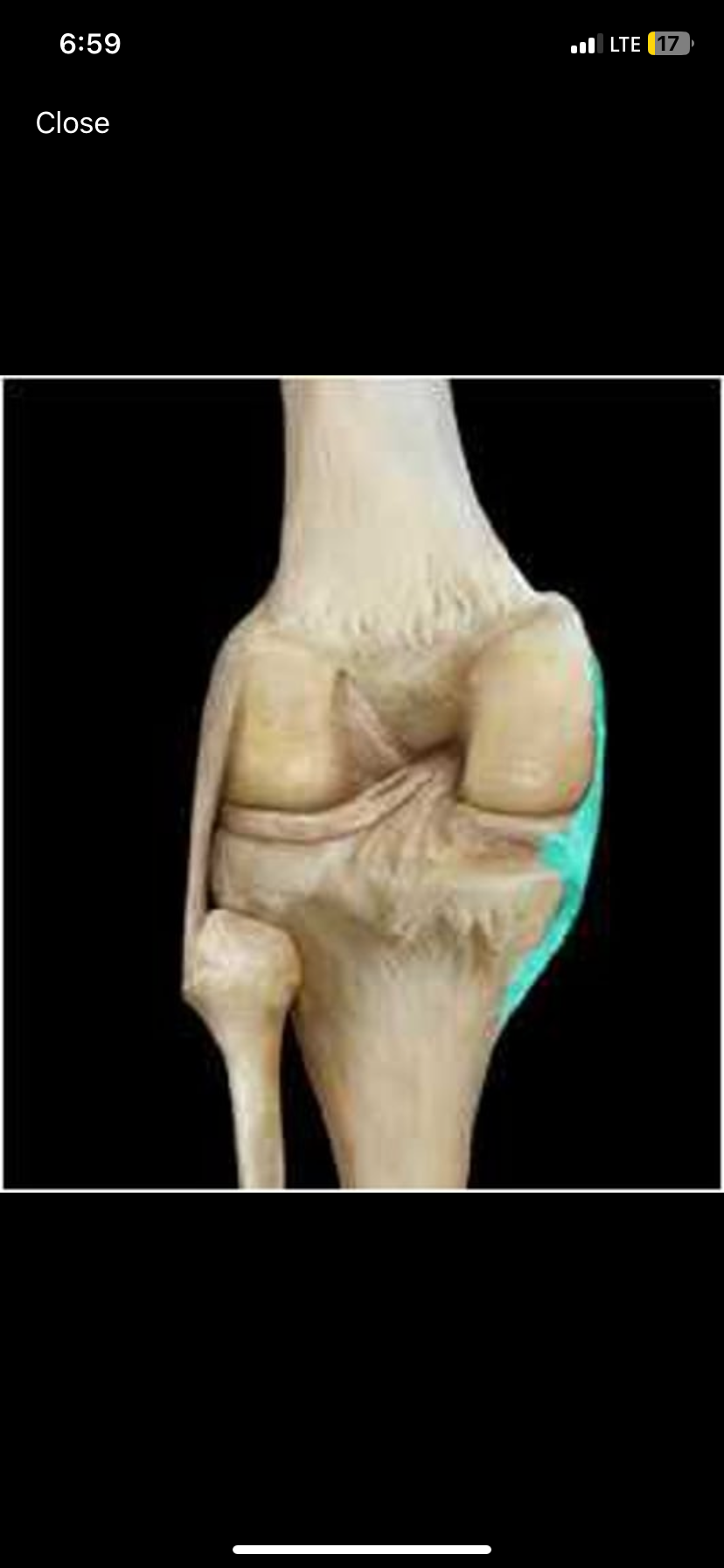 <p>A ligament located on the medial side of the knee joint.</p>