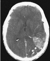 <p>Name the pathology</p>