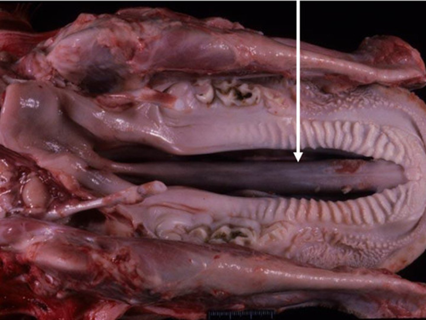 <p>Identify the pathology?</p>
