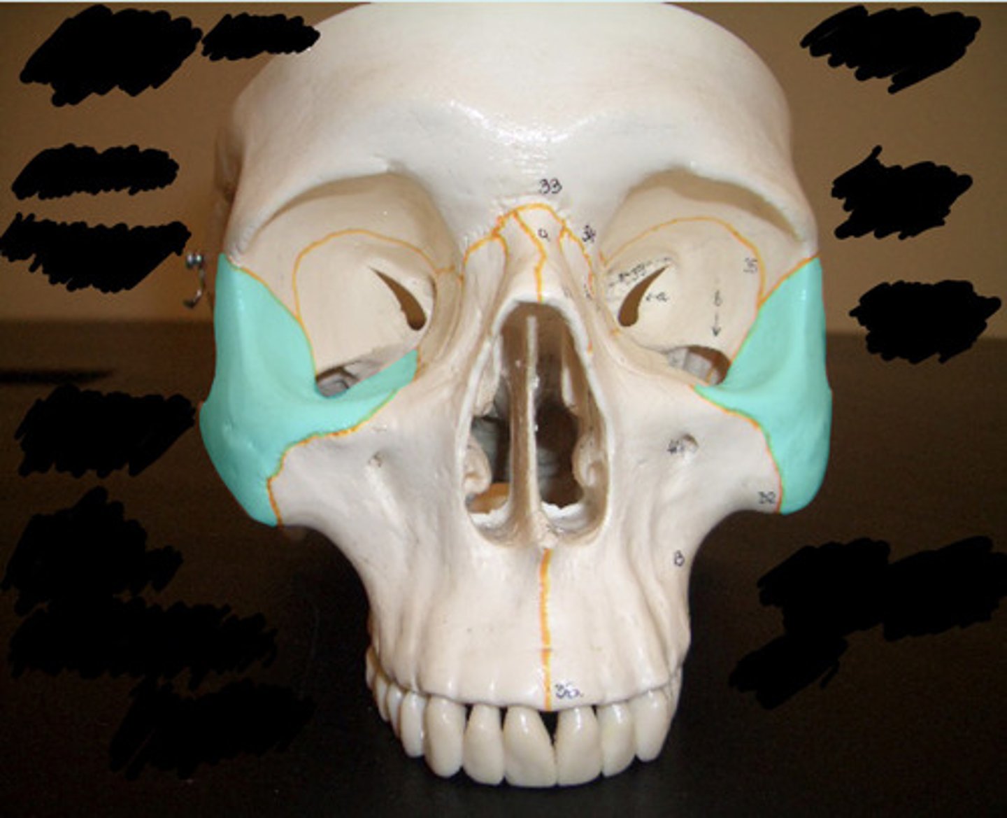 <p>What bone is highlighted here?</p>