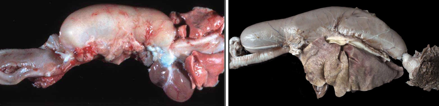 <p>What is Megaesophagus, what are the 2 different forms?</p>