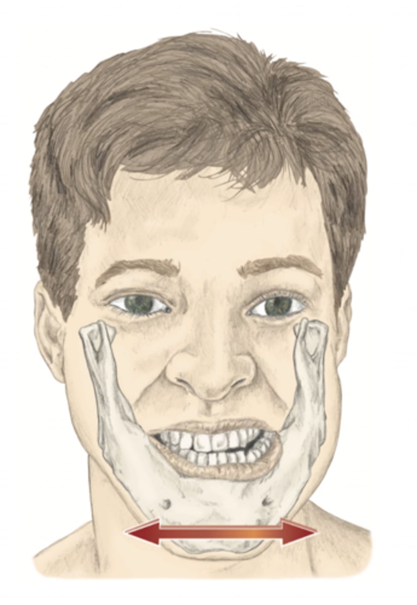 <p>please identify the movement and its location</p>