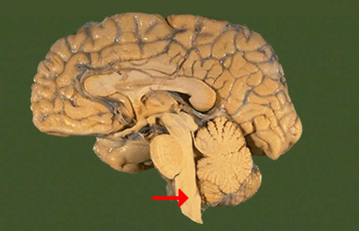 <p>Label this brain part</p>