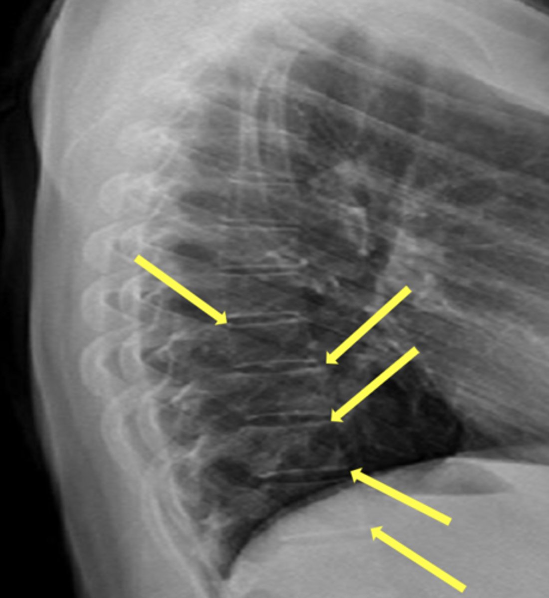 <p>What are the yellow arrows pointing to?</p>