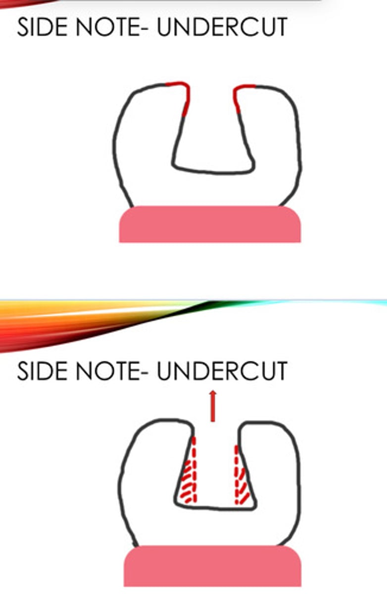 <p>Can make impression harder to remove</p>