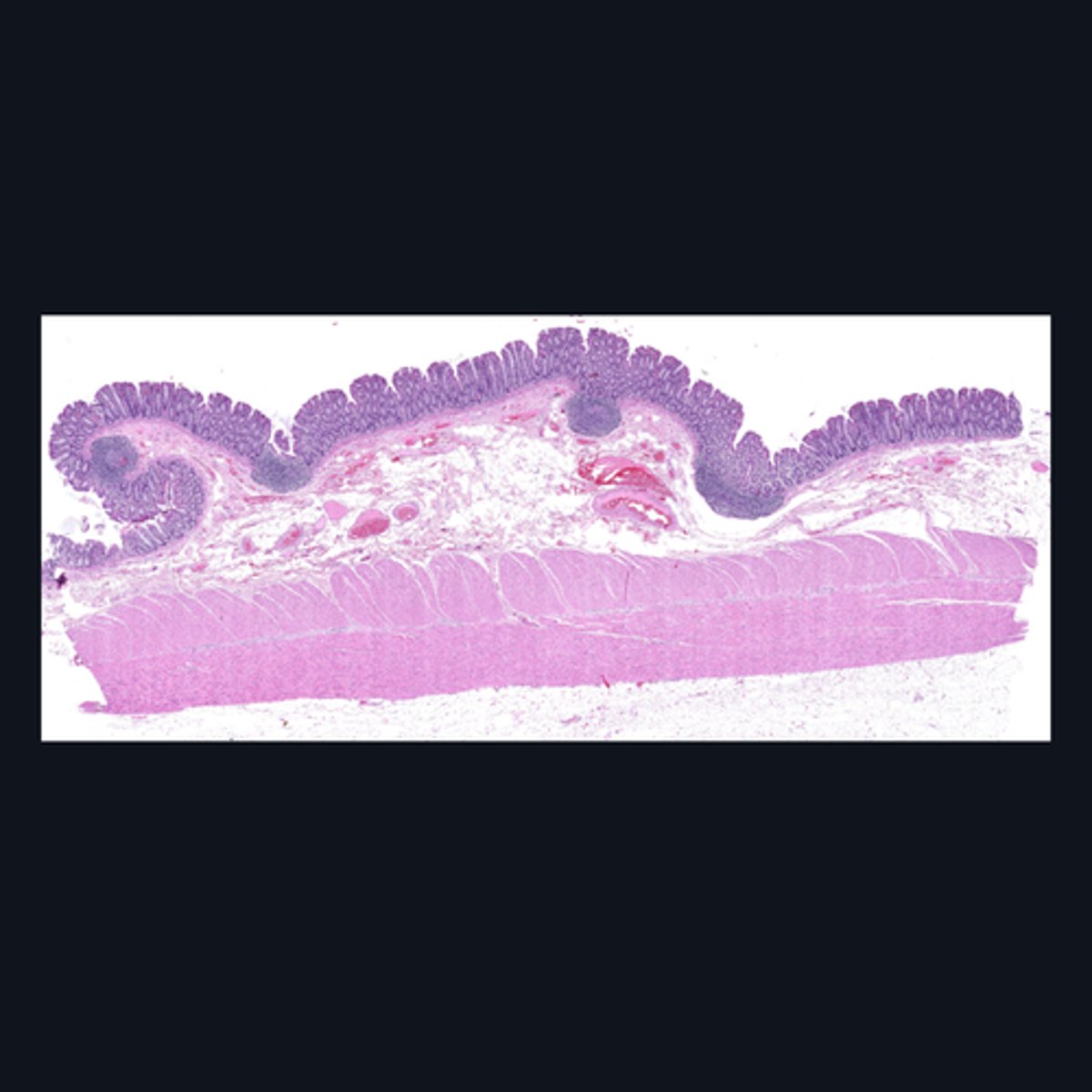 <p>Cells from the division of the nervous system that innervates this specimen are made up of (1)_______, and whose cell bodies and fibers form (2) two ganglionated plexuses named: _______ and ________.</p>