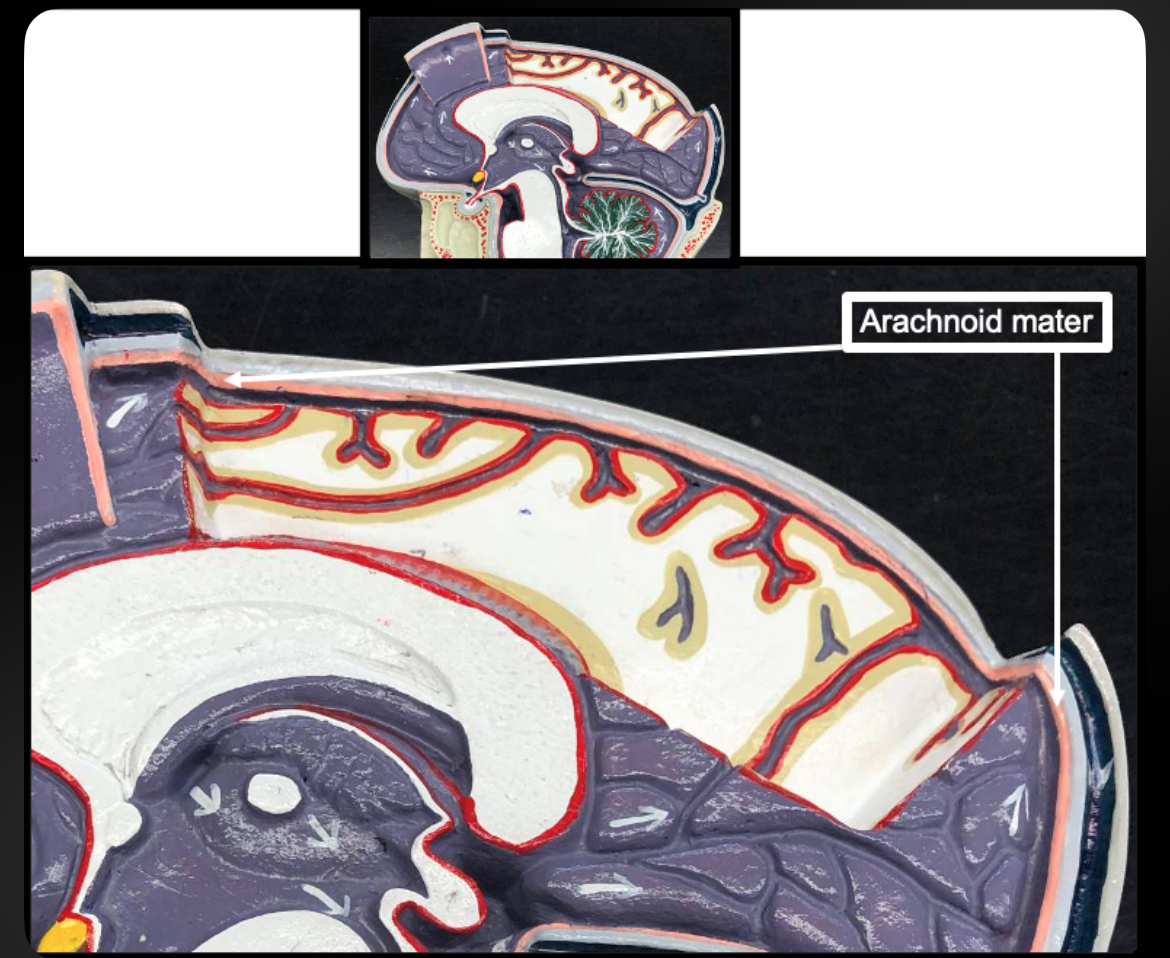 <p>Arachnoid Mater</p>
