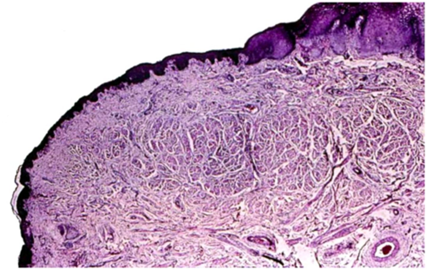 <p><em>what part of the labial mucosa is this:</em></p>