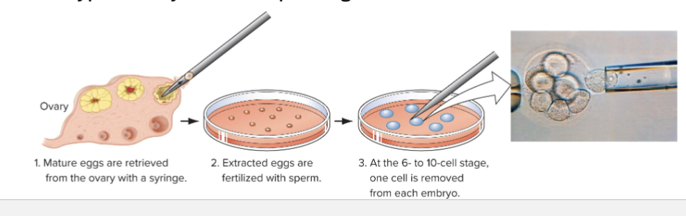<ul><li><p>Prenatal genetic diagnosis</p><ul><li><p>Genotyping fetal cells isolated by aminocentesis: fetal cells in amniotic fluid are extracted using a needle</p></li></ul></li><li><p>Preimplanatation embryo diagnosis</p><ul><li><p>Utilizes in vitro fertilization and PCR</p></li><li><p>Genotype embryos before placing in womb</p></li></ul></li></ul><p></p>
