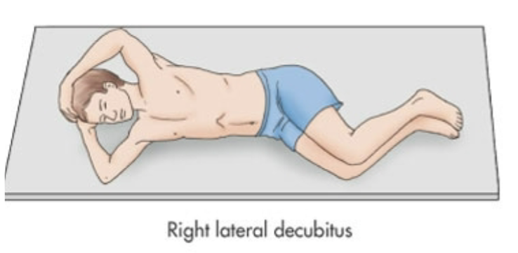 <ol><li><p>Laying directly on right side</p></li><li><p>90 degrees</p></li></ol>