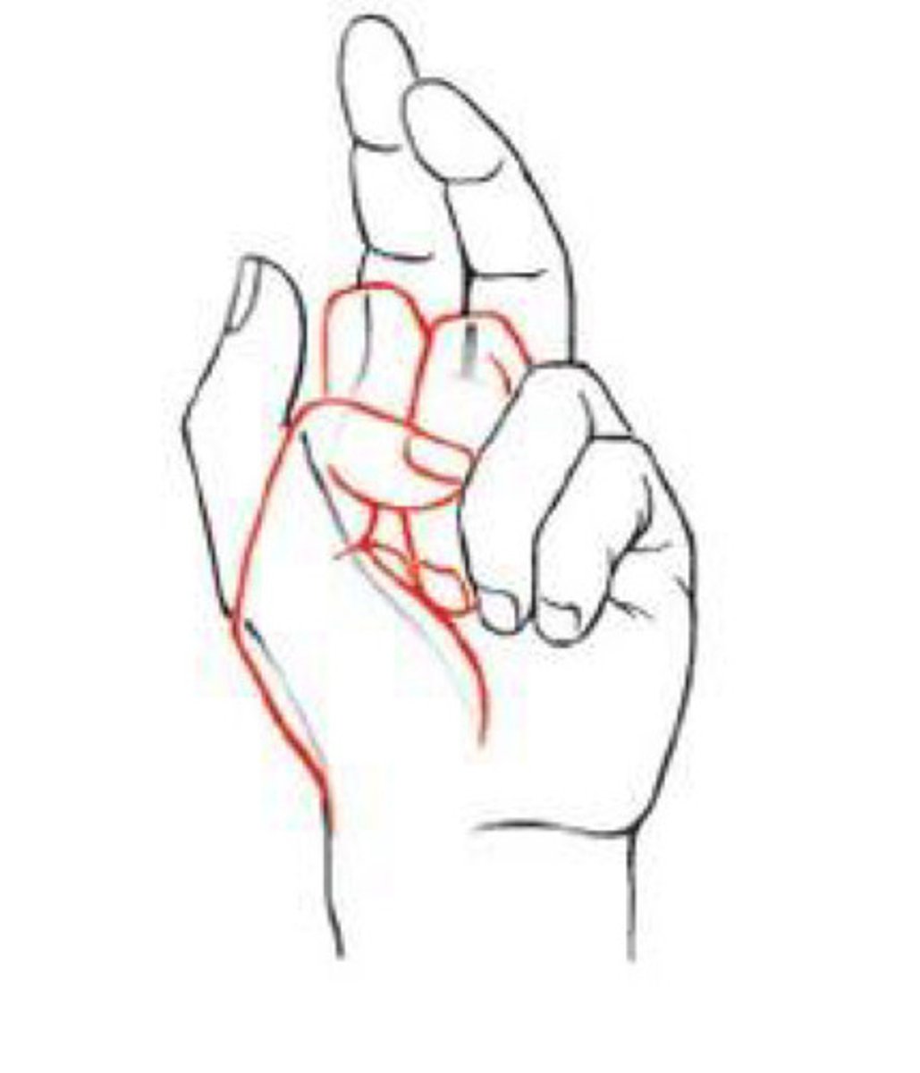 <p>What is the clinical significance of this picture? What nerve is assessed?</p>