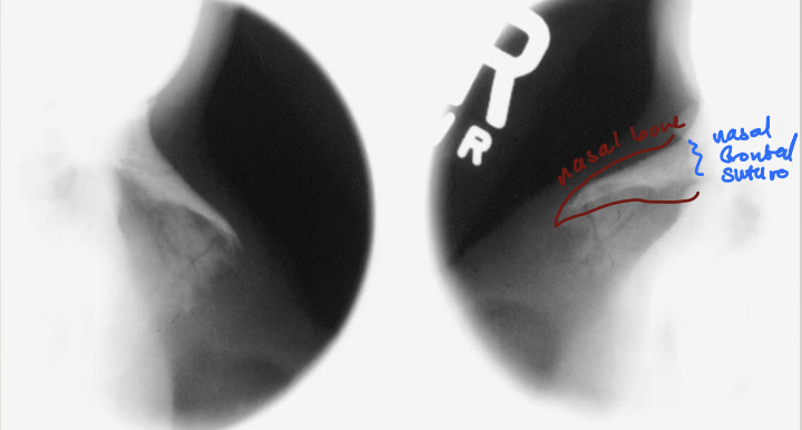 <p>what is this projection</p>