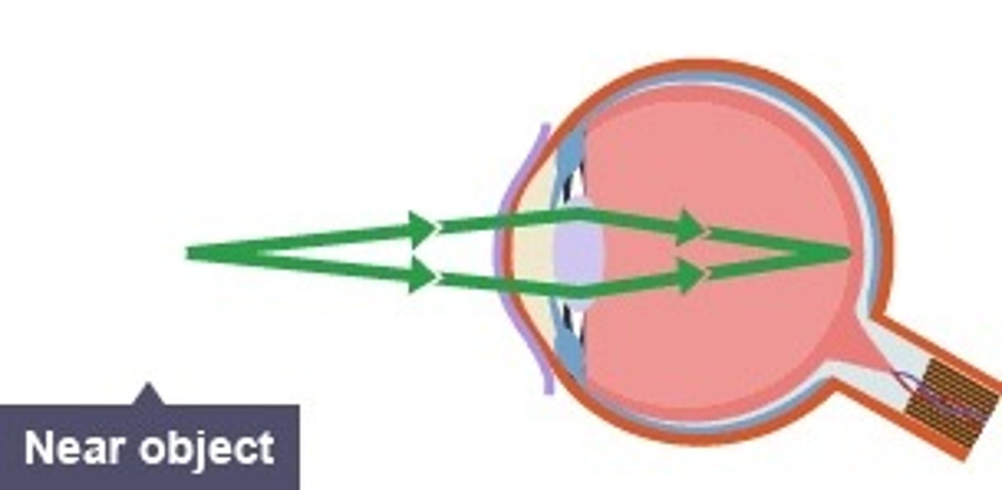 <p>-ciliary muscles contract</p><p>-suspensory ligaments slacken</p><p>-lens becomes thicker and refracts light more strongly</p>