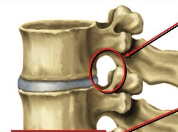 <p>Formed from vertebral notches of adjacent vertebrae, and passageway for spinal nerves. Spinous process of one vertebrae and the spinous process of a vertebrae below it form this.</p>