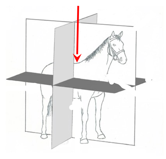 <p>What Body Plane is this?</p>