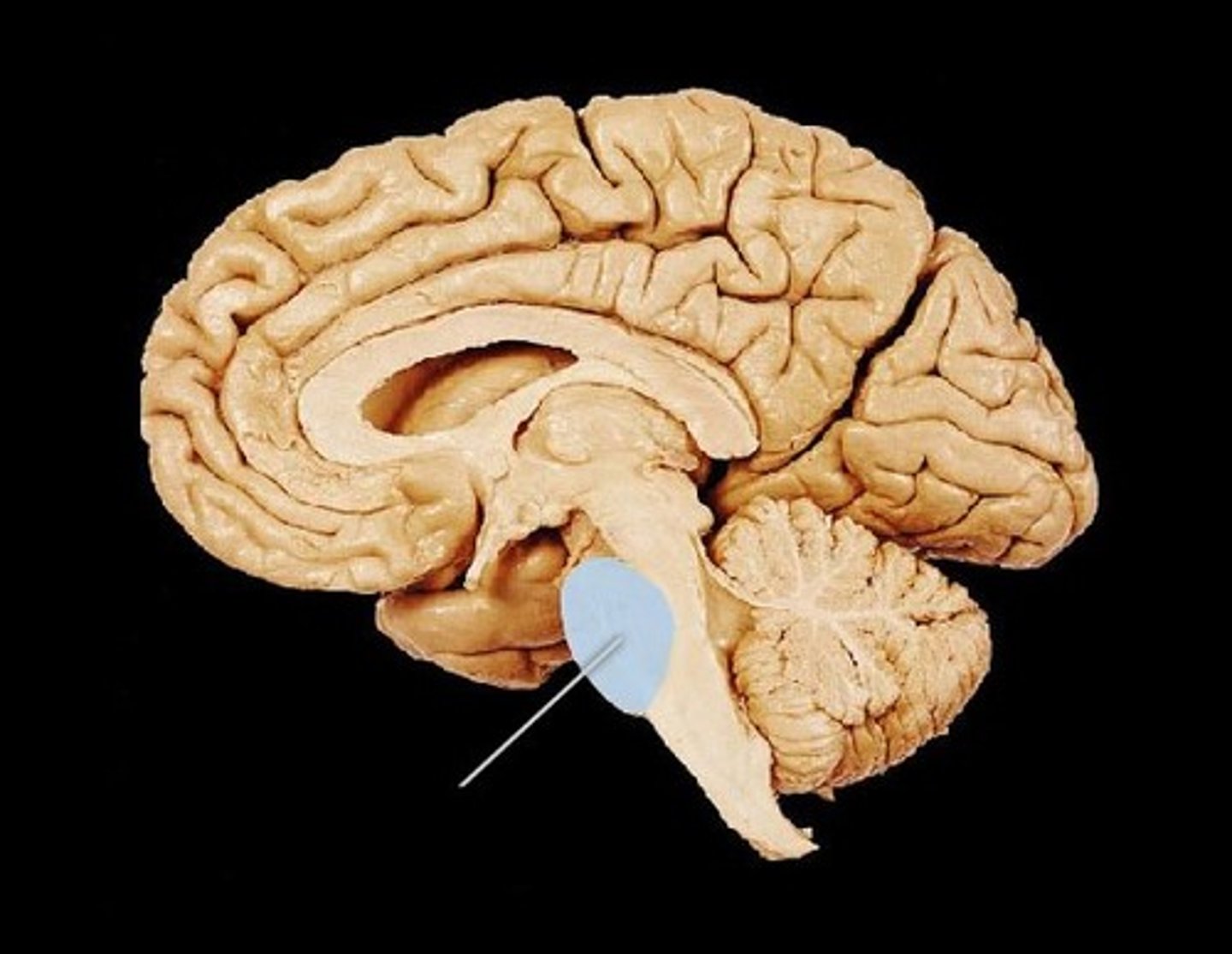 <p>- anterior: axonal tracts</p><p>- posterior: a variety of nuclei (groups of neuron cell bodies) and axonal tracts</p>