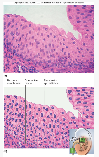 <p>Appearance:</p><ul><li><p>Somewhat resembles stratified squamous<br>epithelium but w/ rounded surface cells that<br>bulge at the surface</p></li><li><p>Typically 5-6 cells thick when relaxed, only 2-3 cell<br>layers thick when stretched</p></li><li><p>Some cells have two nuclei</p></li></ul><p>Locations:</p><ul><li><p>Urinary tract – kidney, bladder, ureter, urethra</p></li></ul><p>Functions</p><ul><li><p>stretching to allow filling of urinary tract</p></li><li><p>protects underlying tissues from damage by urine</p></li></ul><p></p>