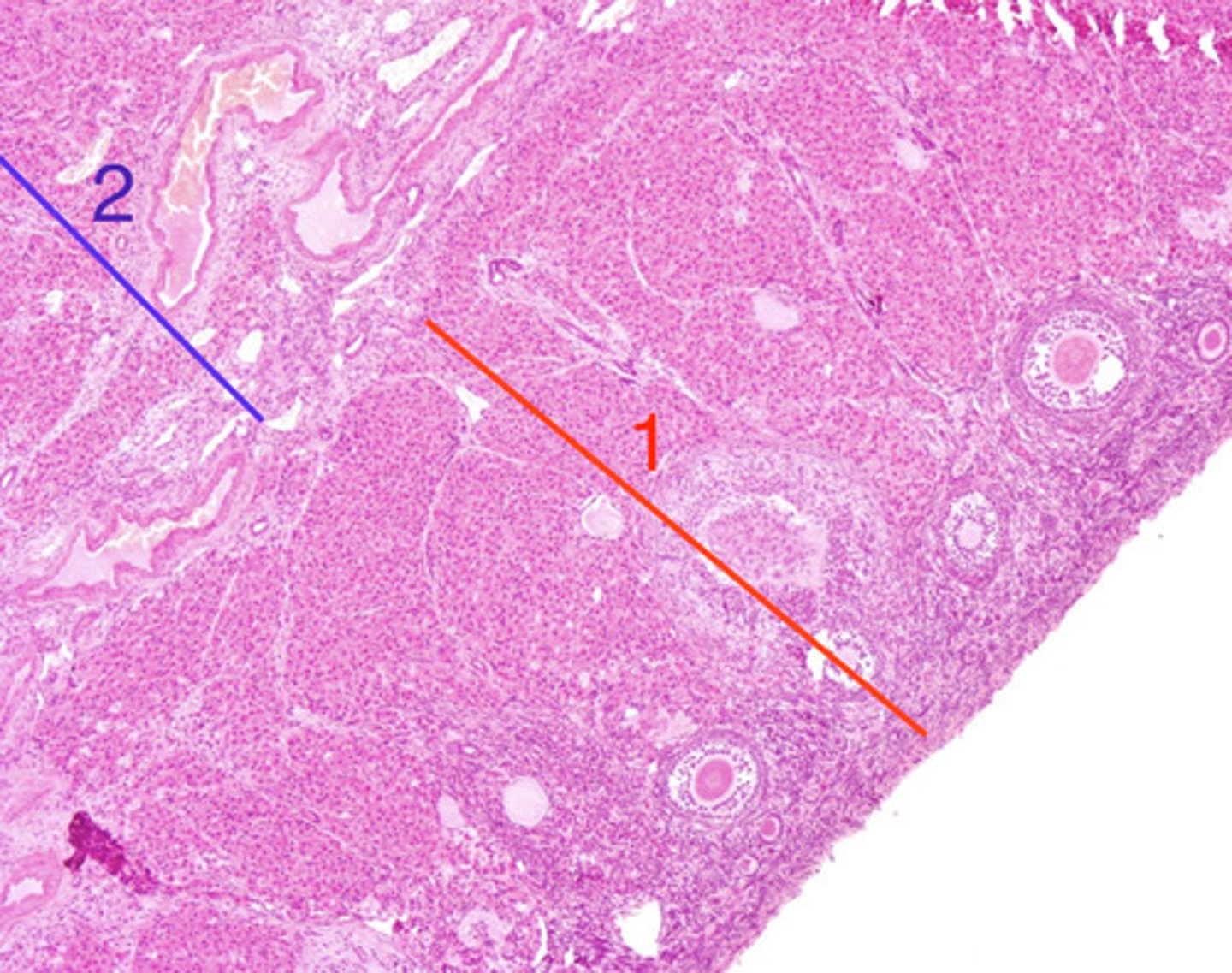 <p>ovary- what is 1?</p>