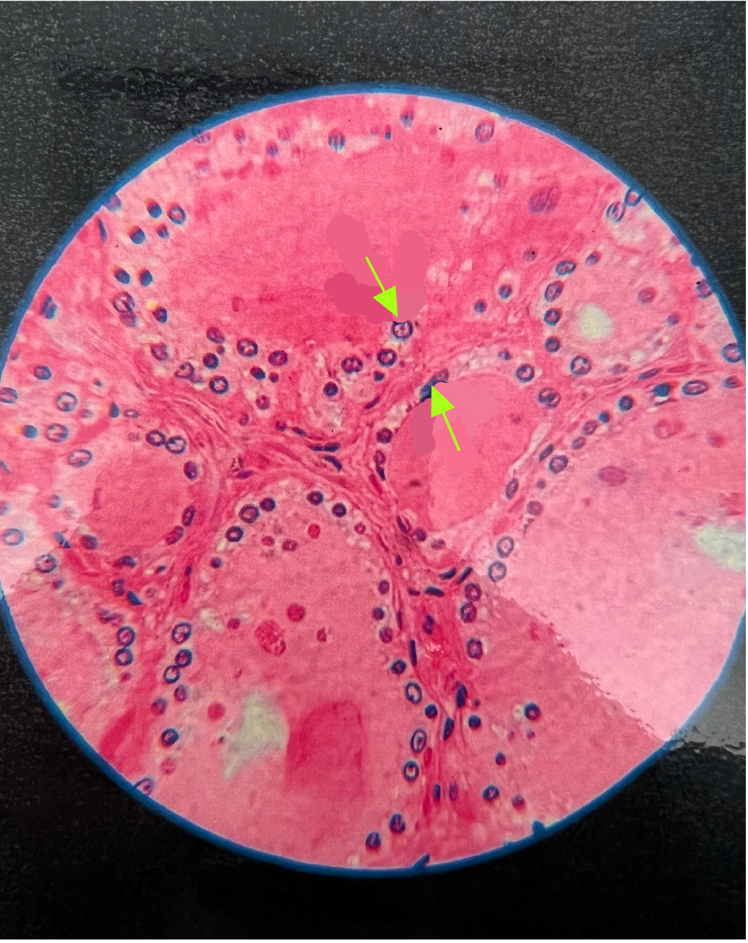 what hormone is secreted by these cells?