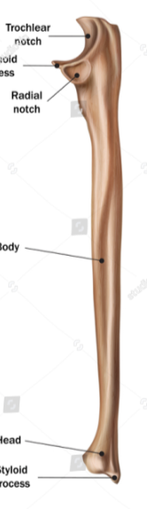 <p>radial notch of ulna</p>