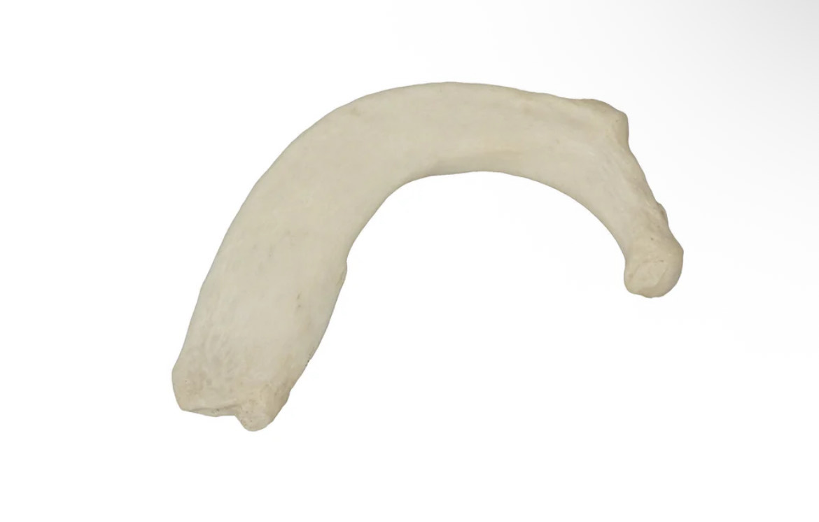 <p>what bone is this?</p>