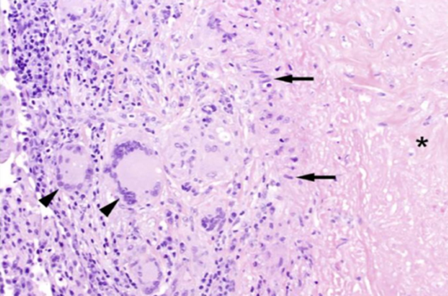 <p>What are the cells dictated by the arrow heads and what are their function?</p>