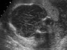 <ol><li><p>What is abnormal about this image?</p></li><li><p>This finding can be associated with what pathologies?</p></li></ol><p></p>