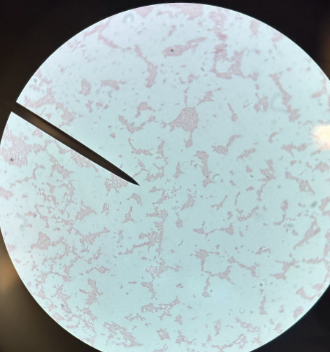 <p>gram negative rods: </p>