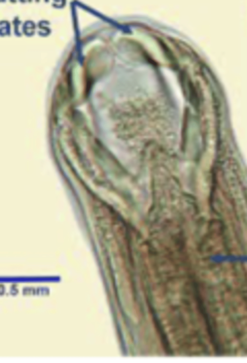 <p>Isolated in a dog with low albumen content and anaemia. What parasite is this?</p>
