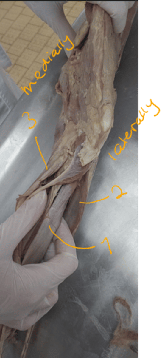 <p>identify the muscles.</p>
