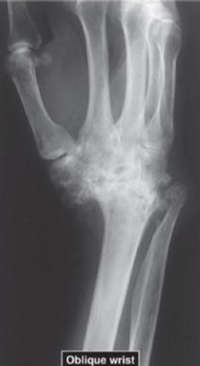 term image