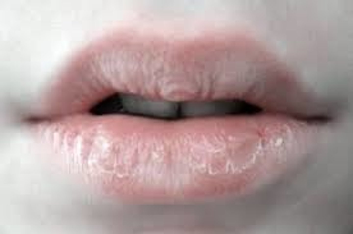 <p>labios agrietados, labios partidos</p>
