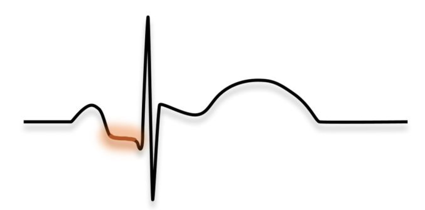 <p>What segment is this</p>