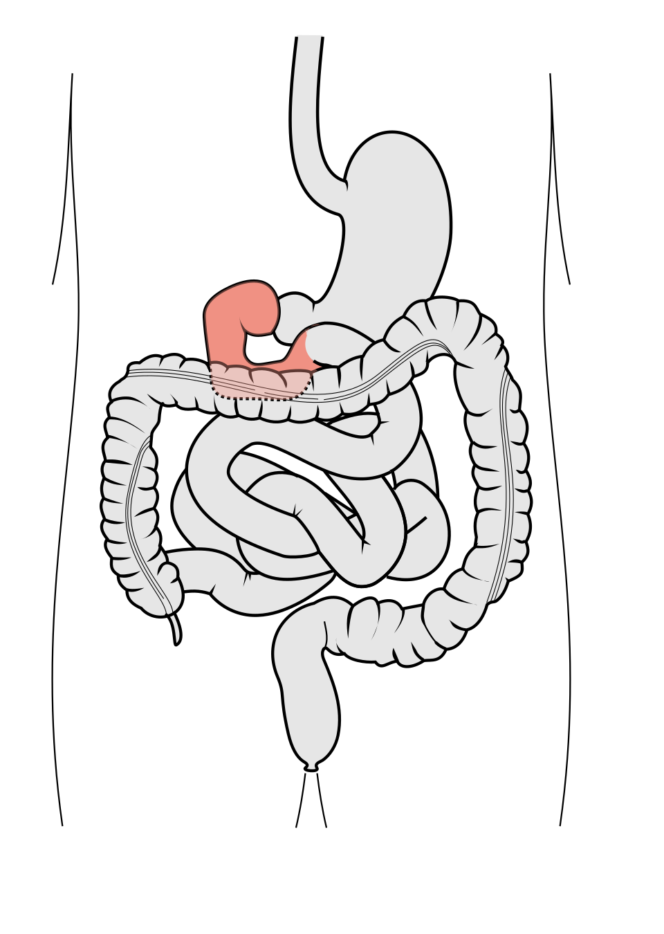 <p>The <strong><em><em></em></strong><strong><em></em></em></strong> is the first part of the small intestine, where a significant amount of chemical digestion occurs after food leaves the stomach.</p>