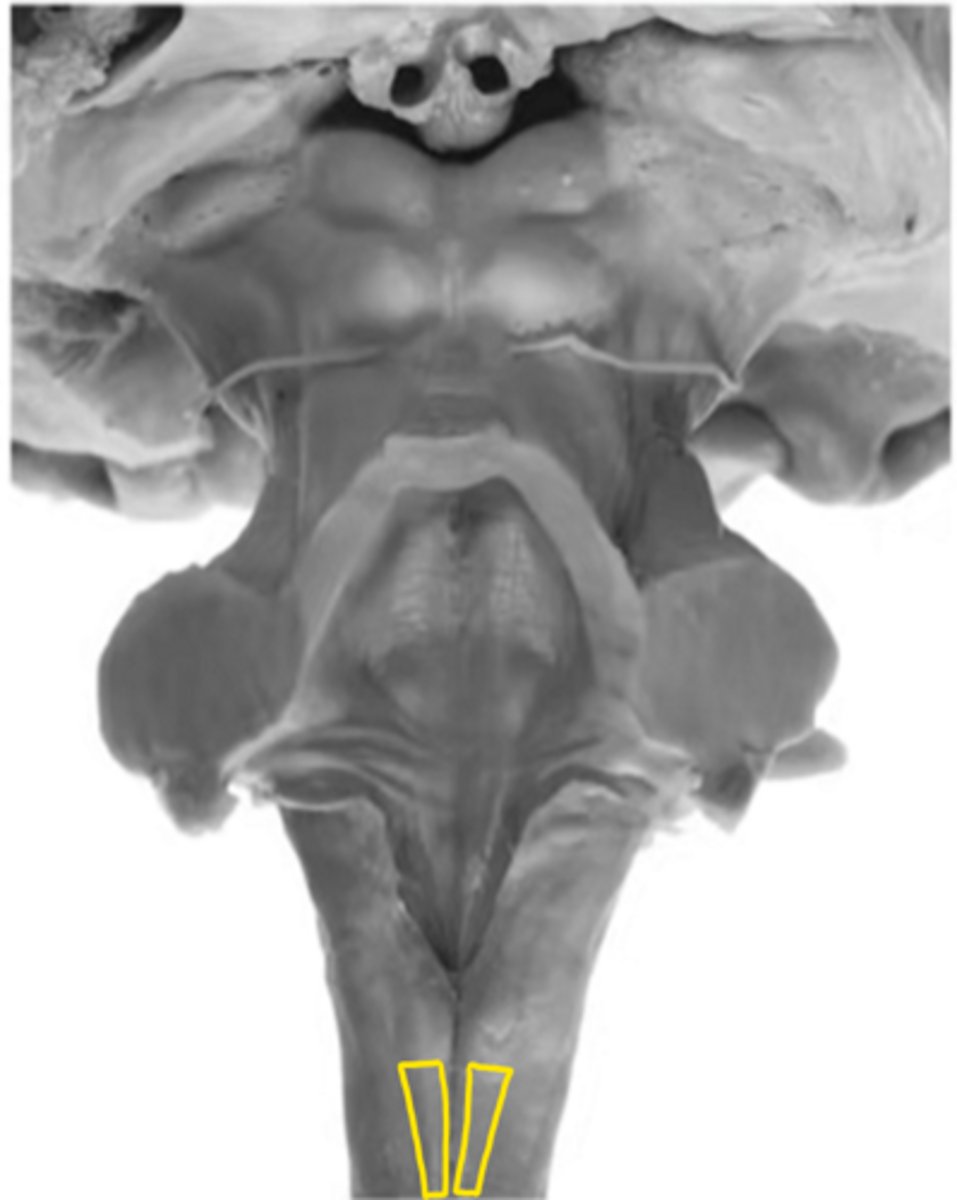 <p>ID the fibers</p>