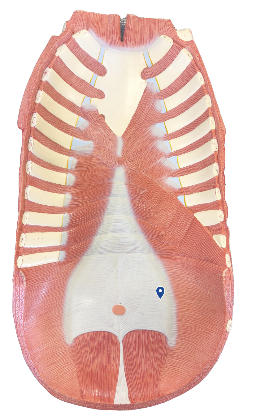 <p>What muscle is the arrow pointing to?</p>