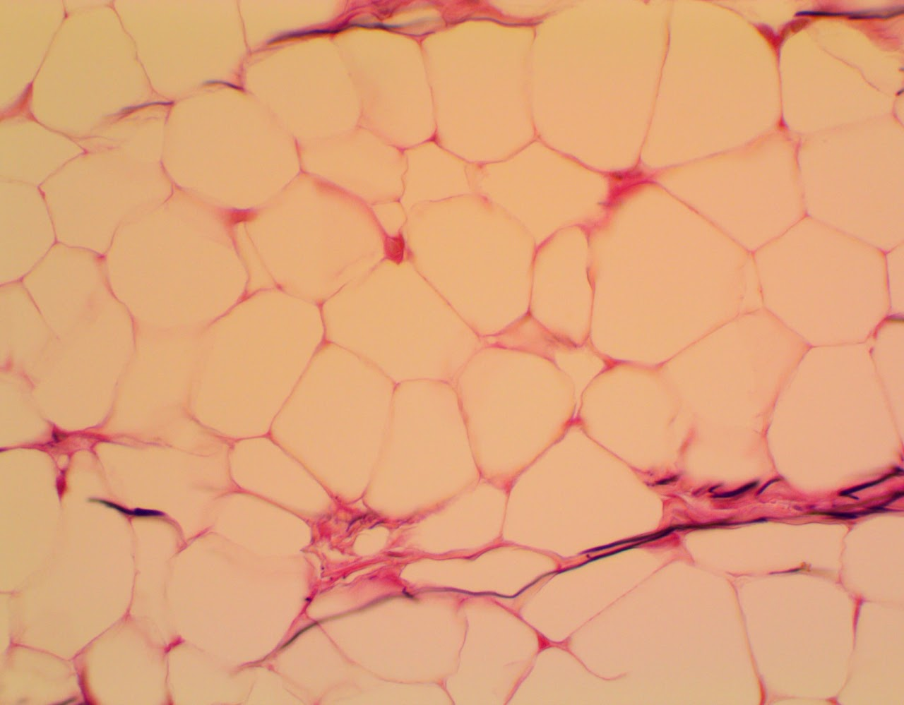 <p><span>Found in all fat tissue, such as subcutaneous tissue</span></p>