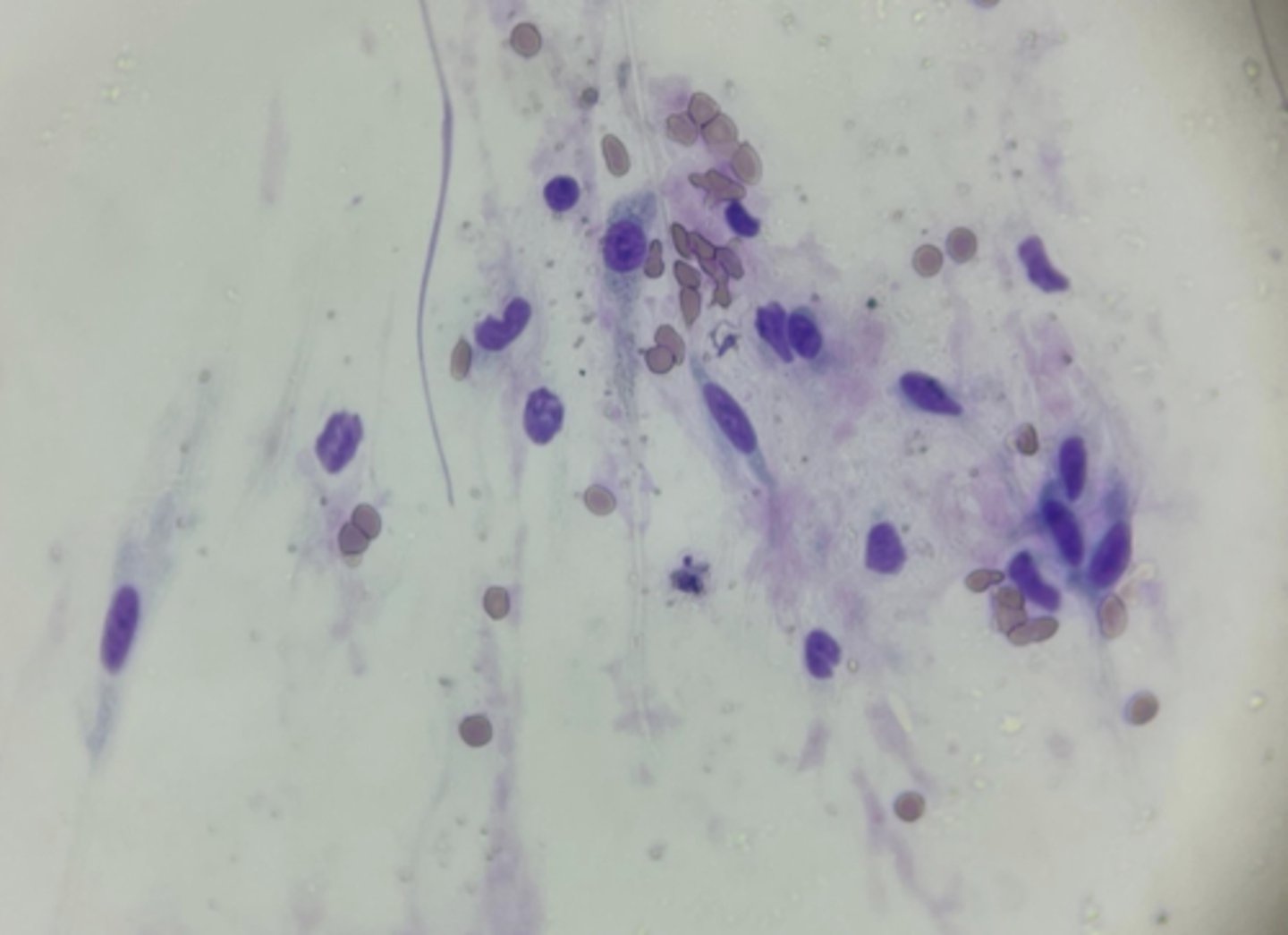 <p>What type of cells are these spindle-shaped, wispy appearing cells?</p>