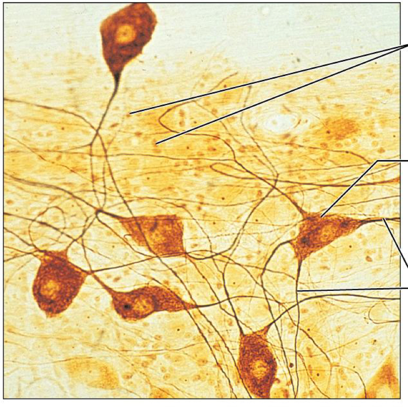 <p>What tissue is this</p>