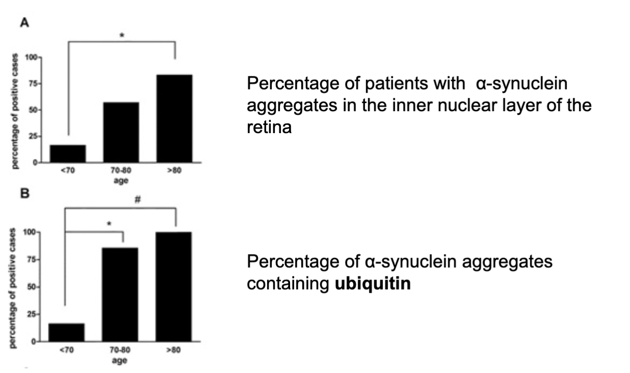<p>increased % of patients with alpha-synuclein aggregates and those containing ubiquitin</p><ul><li><p><span style="background-color: inherit; line-height: 22px; color: windowtext;"><span>Implies that proteasomal degradation is less efficient with age </span></span><span style="line-height: 22px; color: windowtext;"><span> </span></span></p></li></ul><p><span style="background-color: inherit; line-height: 22px; color: windowtext;"><span>Therefore see accumulation of proteins and protein aggregates</span></span><span style="line-height: 22px; color: windowtext;"><span> </span></span></p><ul><li><p class="Paragraph SCXO104001023 BCX0" style="text-align: left;"><span style="background-color: inherit; line-height: 22px; color: windowtext;"><span>In peripheral tissues, skin and organs</span></span></p></li></ul><p></p>