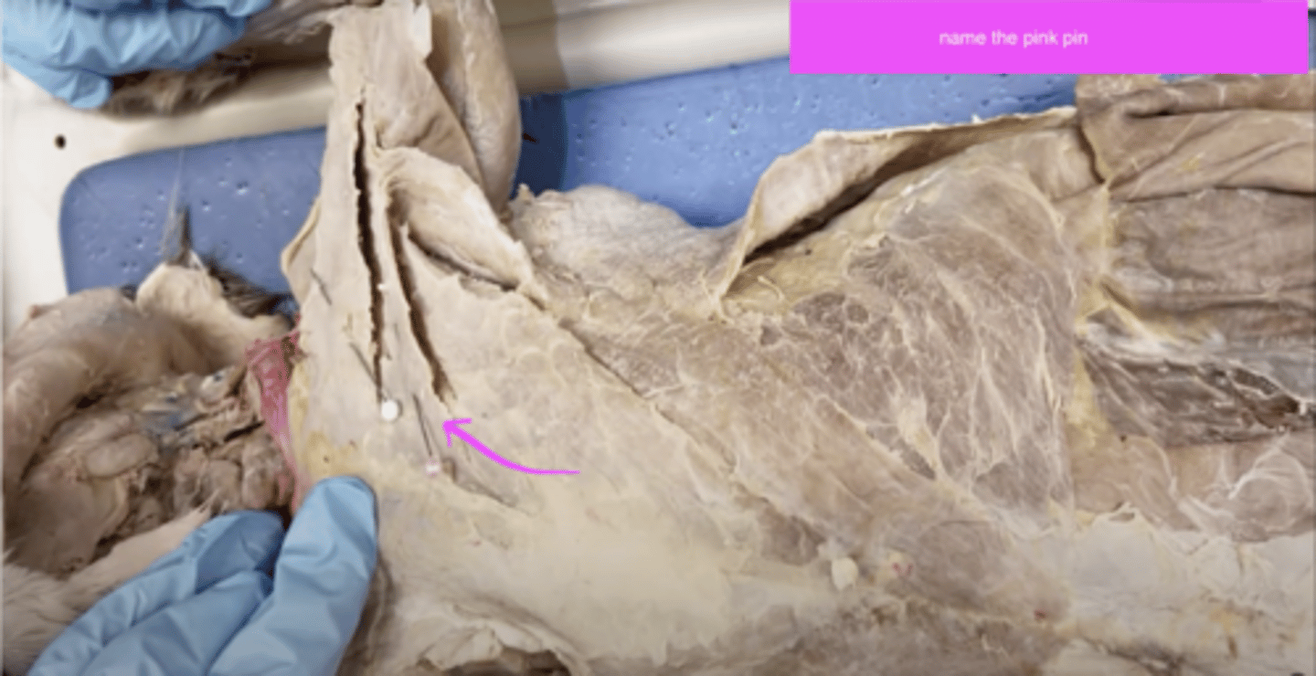 <p>name this muscle</p>