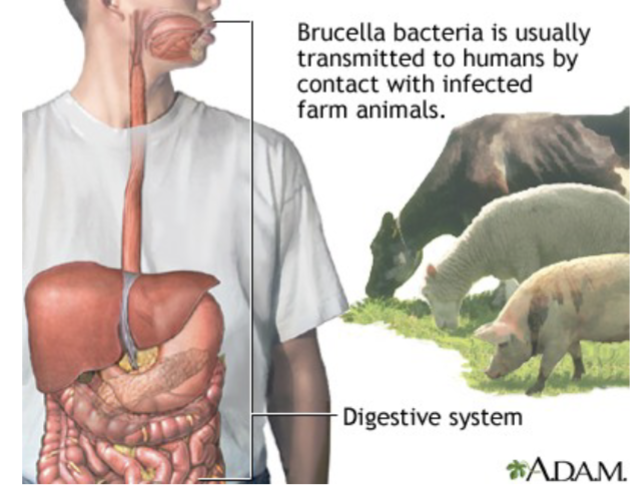 <p>Brucella: General Characteristics:</p>