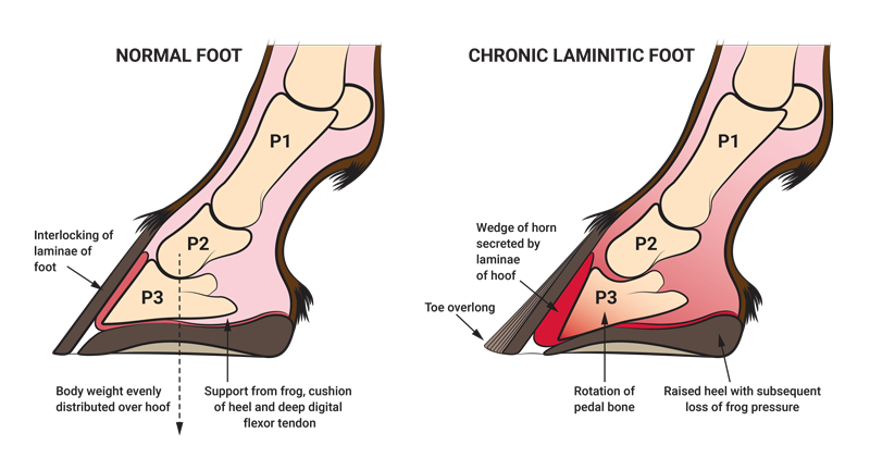 <ul><li><p><span style="font-family: Open Sans, Fallback, sans-serif">inflammation and subsequent separation of the laminae of the hoof</span></p></li><li><p><span style="font-family: Open Sans, Fallback, sans-serif">Causes: carbohydrate overload, excess weight bearing, endotoxemia, high temp, anything that offsets the laminae that hold the coffin bone </span></p></li><li><p><span style="font-family: Open Sans, Fallback, sans-serif">hallmark clinical sign is severe lameness with bounding digital pulses. P3 rotation or sinking can result from laminar separation</span></p><ul><li><p>P3 is the coffin bone</p></li><li><p>usually, the horse will be leaning back on their heels to relieve pressure on their toes</p></li></ul></li></ul><p></p>