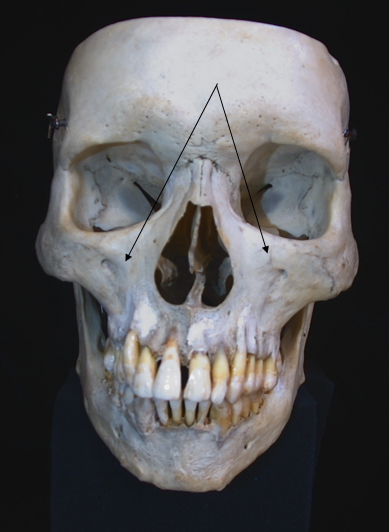 name the bone 