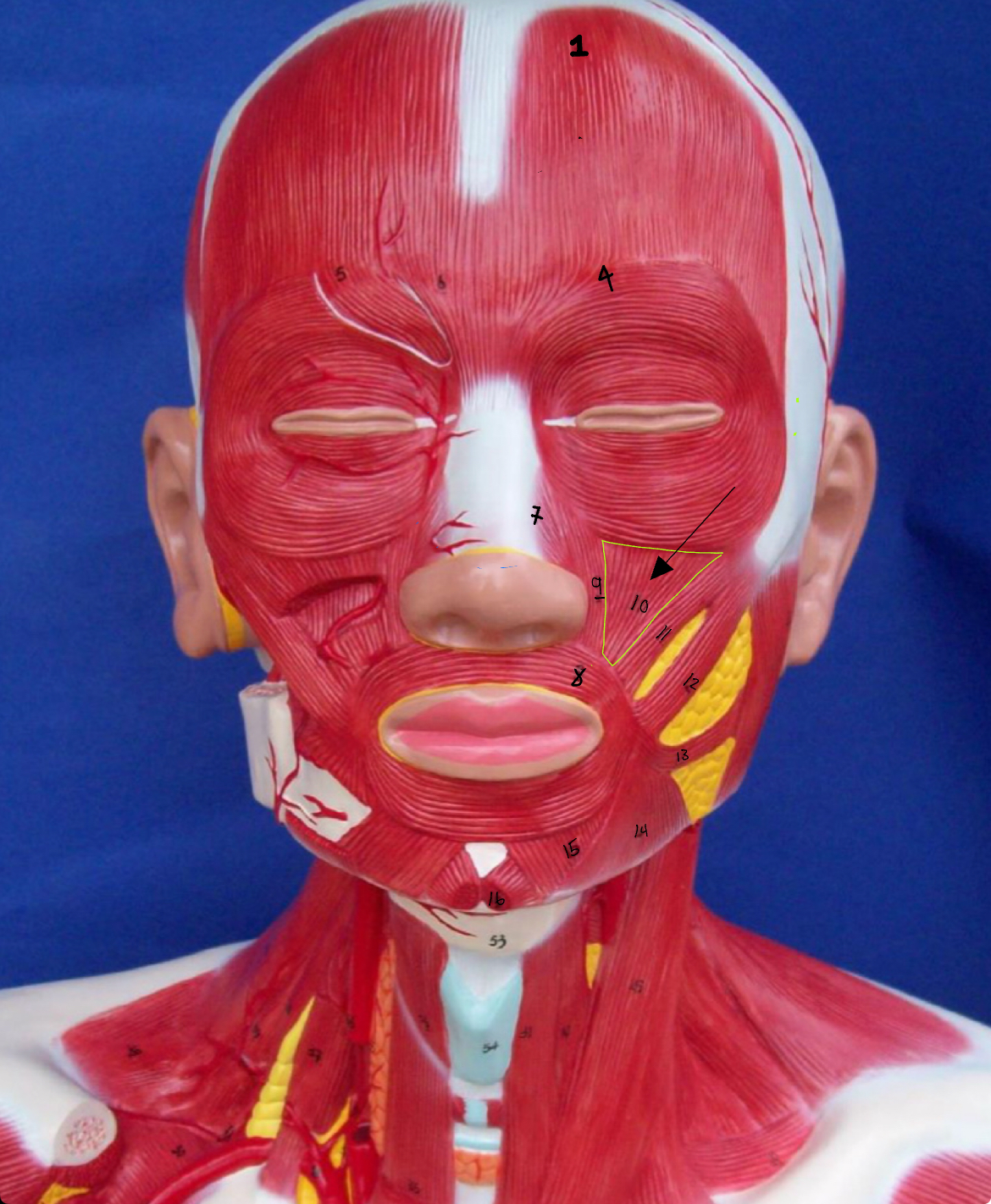 <p>what type of muscle is this (altay)</p>