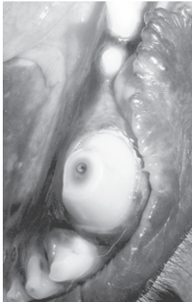 <p>Identify this lesion. What instrument is used to confirm the diagnosis?</p>