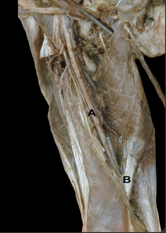 <p>What causes&nbsp;“B”?&nbsp;</p>