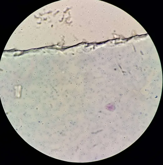 <p><span data-name="microscope" data-type="emoji">🔬</span><span data-name="petri_dish" data-type="emoji">🧫</span><strong><span> </span>Na podstawie zdjęcia preparatu:</strong></p><p></p><ul><li><p><span data-name="book" data-type="emoji">📖</span><span> </span>rozpoznaj gatunek pasożyta;</p></li></ul><p></p><ul><li><p><span data-name="recycle" data-type="emoji">♻</span><span> </span>rozpoznaj wszystkie formy rozwojowe;</p></li></ul><p></p><ul><li><p><span data-name="microbe" data-type="emoji">🦠</span><span> </span>wskaż organelle i cechy charakterystyczne dla danego gatunku;</p></li></ul><p></p><ul><li><p><span data-name="mask" data-type="emoji">😷</span><span> </span>nazwij chorobę, którą pasożyt wywołuje.</p></li></ul><p></p>