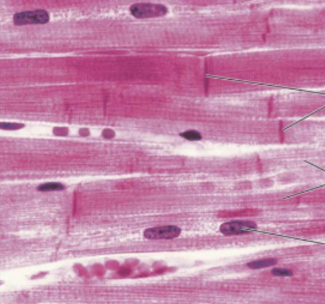 <p>spaced out striations (nuclei spread throughout)</p>