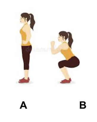 <p>To unlock the knee, when going from position A to position B as shown in the image, which of the following motions is MOST LIKELY to occur?</p><p>A. Lateral rotation of the femur on the tibia</p><p>B. Medial rotation of the femur on the tibia</p><p>C. Lateral rotation of the tibia on the femur</p><p>D. Medial rotation of the tibia on the femur</p>